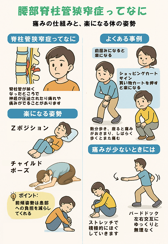 脊柱管狭窄症の仕組みと身体にやさしい姿勢